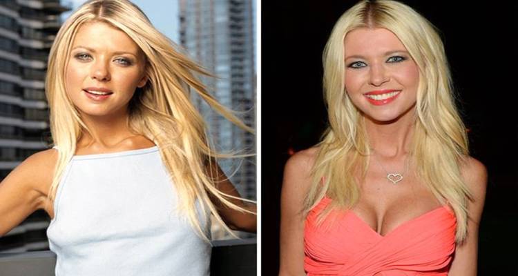 Tara Reid Before And After Breast Implants