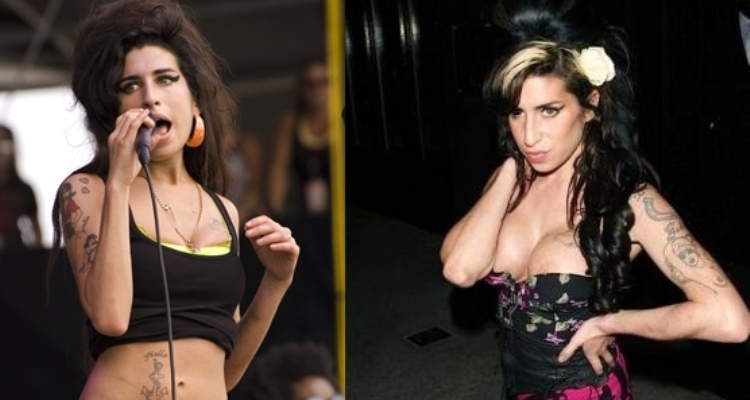 Amy Winehouse Before and After Breast Implants