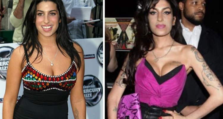 Amy Winehouse Before and After Breast Implants