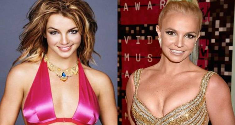 Britney Spears Before and After Breast Implants