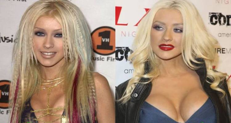 Christina Aguilera Before and After Breast Implants