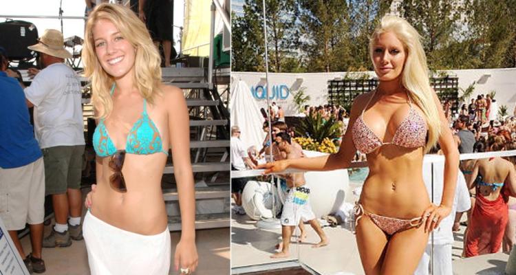Heidi Montag Before and After Breast Implants