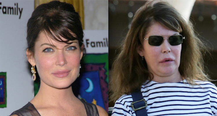 Lara Flynn Boyle Before and After Lip Injections
