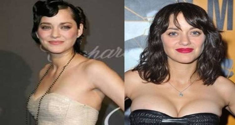 Marion Cotillard Before and After Breast Implants