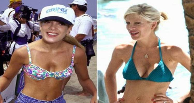 Tori Spelling Before and After Breast Implants