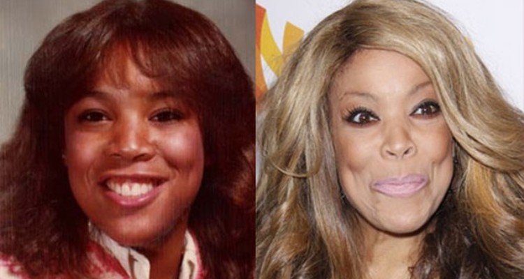 The Description of Wendy Williams Plastic Surgery