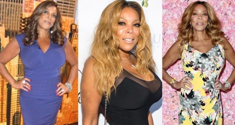 The Description of Wendy Williams Plastic Surgery