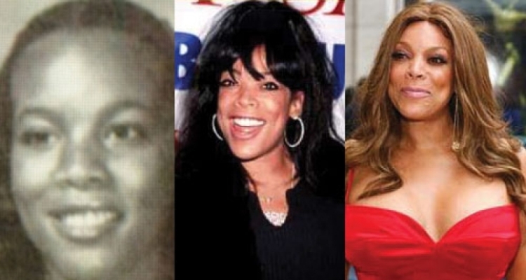 The Description of Wendy Williams Plastic Surgery