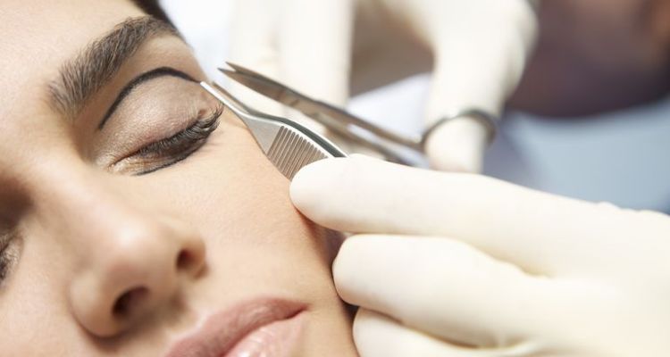Upper Eyelid Surgery Recovery Time after the Operation